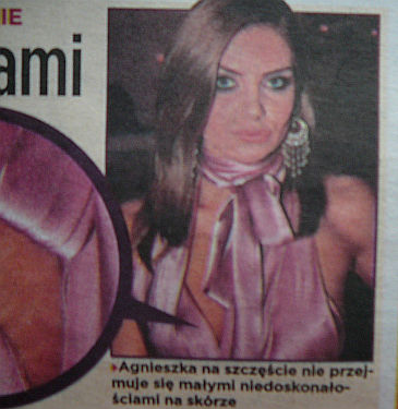 FRYTKA NAGO FRYTKA ROZST�PY